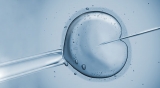 In-Vitro Fertilization Market 2019- Global Industry Details by Overview, Size, Top Manufacturers, Trends, Demand, Overview, Forecast to 2025