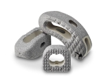 Interbody Devices Market Booming Trends 2019-2025: Spinal Elements Inc, Jemo Spine LLC., Medtronic plc