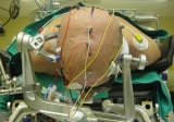 Intraoperative Neurophysiological Monitoring Market 2019- Global Industry Details by Overview, Size, Top Manufacturers, Trends, Demand, Overview, Forecast to 2025