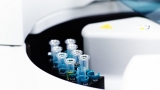 Ion-Selective Clinical Lab Analyzers Market 2019- Global Industry Details by Overview, Size, Top Manufacturers, Trends, Demand, Overview, Forecast to 2025